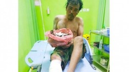 Bandar Narkoba Lukai 2 Anggota Polisi saat Sergap Aktivitasnya Membungkus Ganja