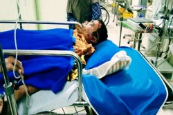 Cari Kayu di Hutan, Warga Riau Kritis usai Berduel dengan Harimau