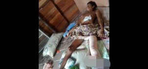 Kapolsek Tambang Bantu Warga Kualu Korban Laka Lantas Dengan Kondisi Menyedihkan