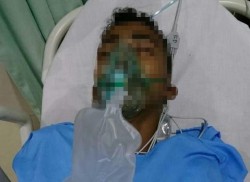 Remaja Korban Penganiayaan Oknum Polisi Akhirnya Meninggal