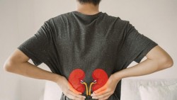 Sering Minum Air Putih Belum Tentu Baik, Dokter Ungkap Alasannya